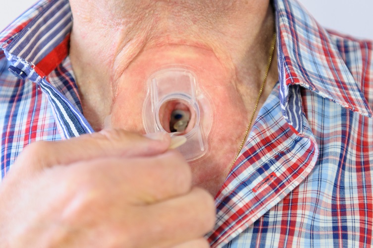 Provox Plug verwijderen | Atos Medical